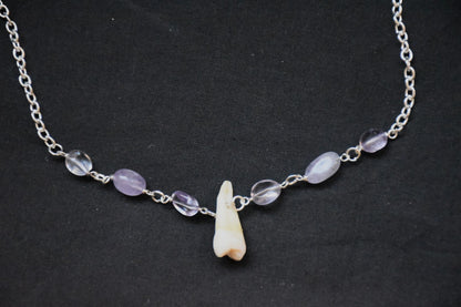 Human teeth necklace
