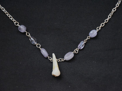 Human teeth necklace