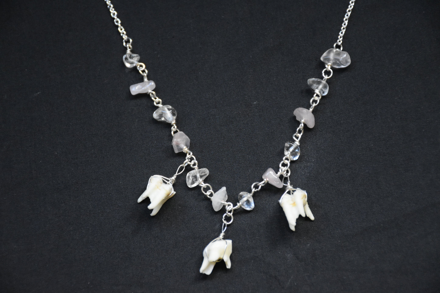 Teeth necklaces