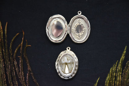Tooth lockets