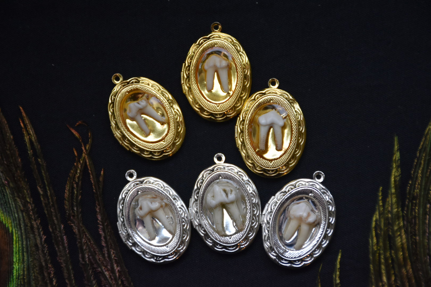 Tooth lockets