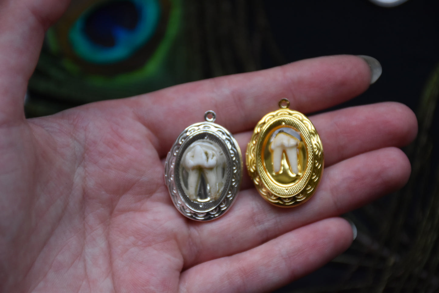Tooth lockets