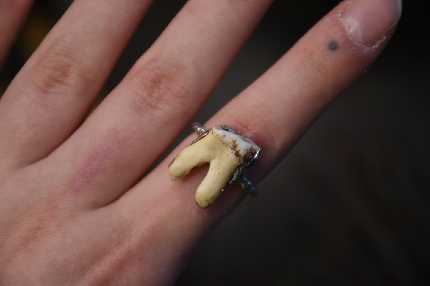 Soldered tooth rings