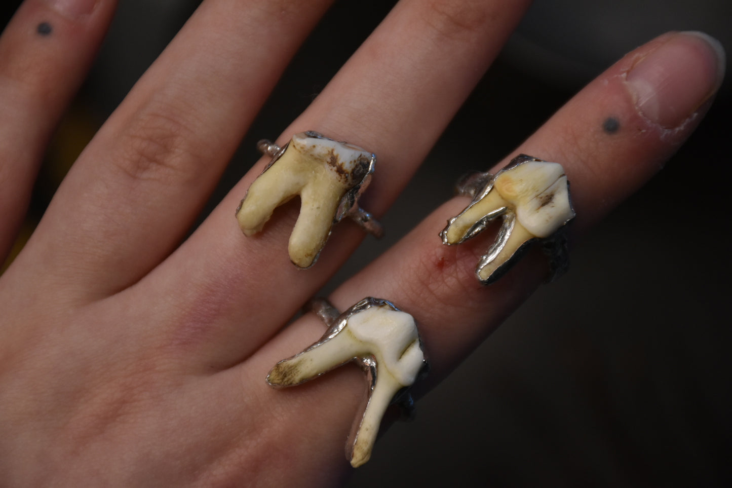Soldered tooth rings